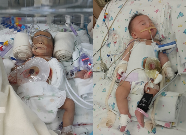 수차례 죽음과 맞서 싸운 유환이