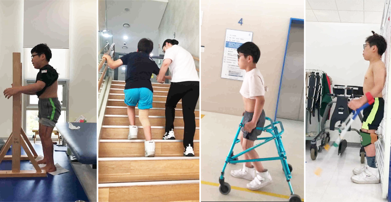 상지로 균형을 잡으며 서있는 훈련, 계단을 처음으로 오르는 모습, 팔로 워커를 끌다가 걷기 시작한 모습, 다리를 믿고 두 손을 떼보는 훈련 (왼쪽부터. 김하나 물리치료사 제공)